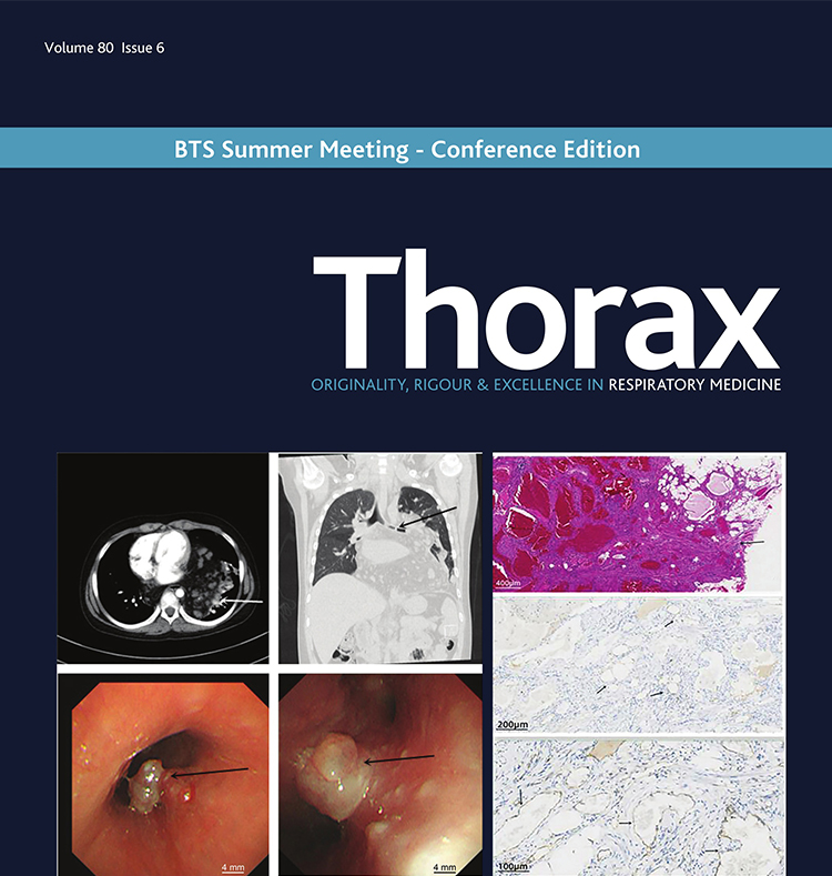 Thorax